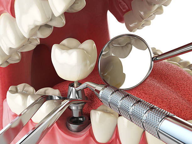 Best Emergency Treatment for Toothache in Glen Gardner, NJ